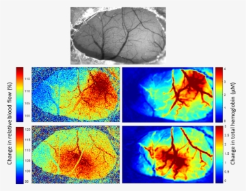 Mslsi I2 - Laser Speckle Imaging Brain, HD Png Download, Free Download