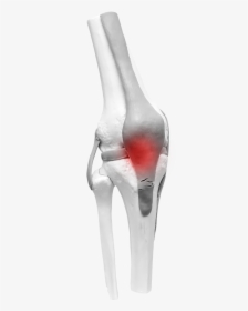 Bone Joint Png, Transparent Png, Free Download