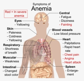 Symptoms Of Anemia - Know If You Re Anemic, HD Png Download, Free Download