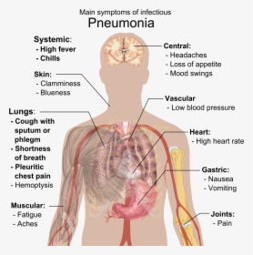 Pneumonia Symptoms, HD Png Download, Free Download