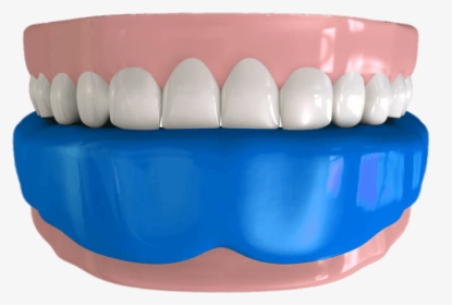 Mouthguard On Lower Teeth Illustration - Smile, HD Png Download, Free Download