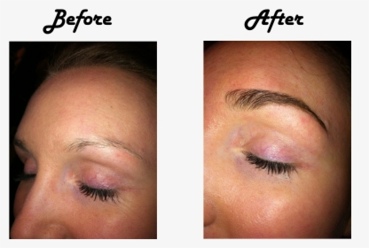 Prp Treatment For Eyebrows , Png Download - Prp Treatment For Eyebrows, Transparent Png, Free Download