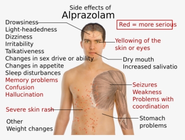 Side Effects Of Alprazolam, HD Png Download, Free Download