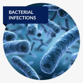 Bacterial Infection, HD Png Download, Free Download