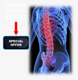 Image Of Spine And Offer Link Button - Human Metabolic Bone Disease, HD Png Download, Free Download