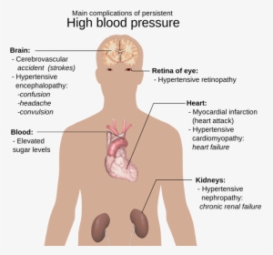 Anatomy Of The Human Body, Big Picture, Hypertension - Complications Of Diabetes Hearing Loss, HD Png Download, Free Download