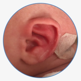 Baby Photo With Ear Buddies - Macro Photography, HD Png Download, Free Download