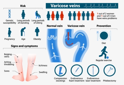 Varicose Veins Infographic, HD Png Download, Free Download