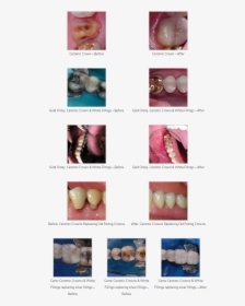 Cosmetic Dentistry, HD Png Download, Free Download
