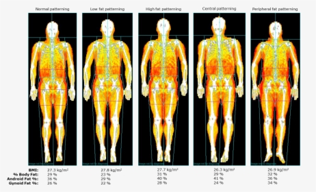 Figure 6 Fat - Body Composition Dexa Scan, HD Png Download, Free Download