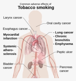 Effects Of Smoking - Effect Of Smoking On Your Body, HD Png Download, Free Download