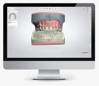 Orthodontic Planner 3shape, HD Png Download, Free Download