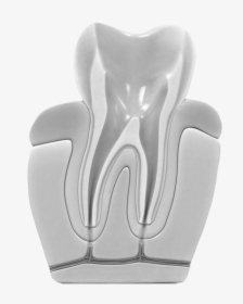 Root Canals - Endodoncia Limpieza, HD Png Download, Free Download