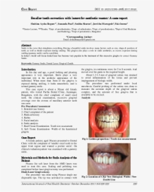 Dental Braces - Tooth Bleaching, HD Png Download, Free Download