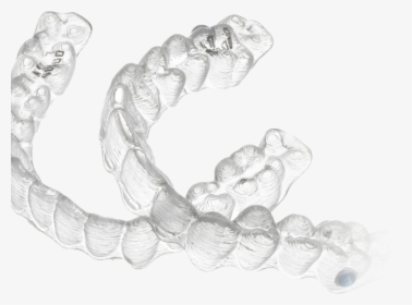 Invisalign Teen, HD Png Download, Free Download