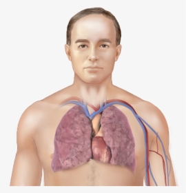 Lung Disease Pulmonary Fibrosis, HD Png Download, Free Download