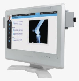 Medical Touch Screen Computer With Battery And Mounting - Computer Monitor, HD Png Download, Free Download