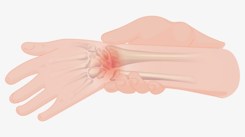 Wrist Pain - Climbing Wrist Injury, HD Png Download, Free Download