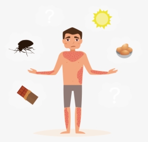 What Causes Hives, HD Png Download, Free Download