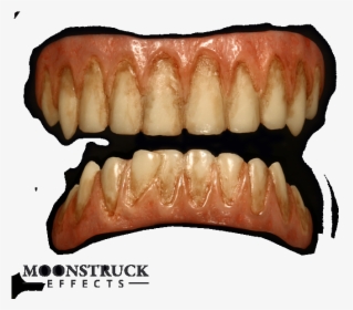 Tooth, HD Png Download, Free Download