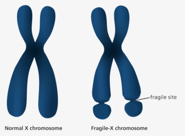 An Illustration Showing The Appearance Of Normal And - Fragile X Syndrome In Women, HD Png Download, Free Download
