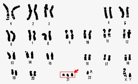 Lou Gehrig's Disease Chromosome, HD Png Download, Free Download