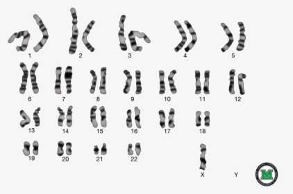 Picture - Hurler Syndrome Chromosome 4, HD Png Download, Free Download