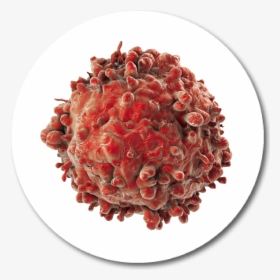 Cancer Cell Png - Real Cancer Cells, Transparent Png, Free Download