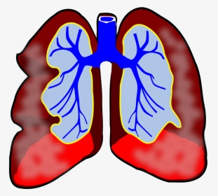Pulmones, Humana, Diagrama, Respiratorio, La Biología - Lung With Cancer Clipart, HD Png Download, Free Download