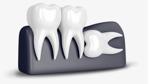 Wisdom Tooth Extraction - Tooth Wisdom, HD Png Download, Free Download