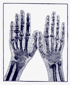 X-ray Image Clip Arts - Hand Bones .png, Transparent Png, Free Download