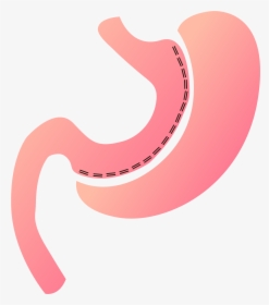 Artboard 46@300x - Gastric Sleeve Png, Transparent Png, Free Download