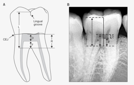 Lingual Aspect Of Mandibular First Molar, HD Png Download, Free Download