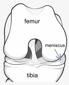 Meniscus Shock Absorber - Patellar Dislocation, HD Png Download, Free Download