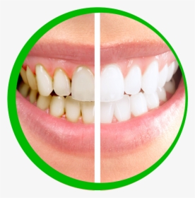 Tooth Care Png - Dental Clinic Images Png, Transparent Png, Free Download