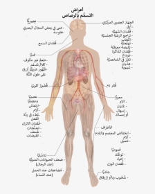 Symptoms Of Lead Poisoning -ar - Lead Poisoning, HD Png Download, Free Download