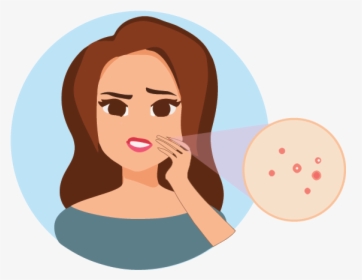 Acne Png, Transparent Png, Free Download
