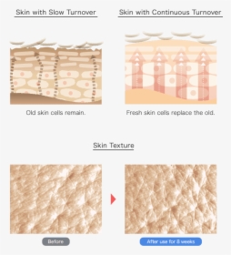 Skin Turnover, HD Png Download, Free Download