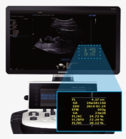 Hycosy In Ceus - Samsung Ws80a Ultrasound Machine, HD Png Download, Free Download