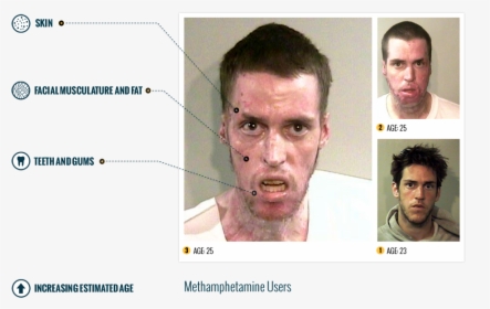 Methamphetamemes Drugs Effects, HD Png Download, Free Download