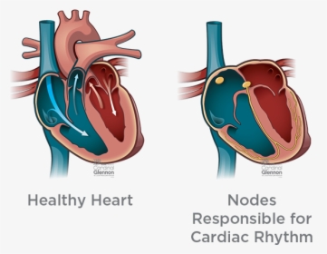 Nodes Responsible For Cardiac - Children’s Healthcare Of Atlanta, HD Png Download, Free Download