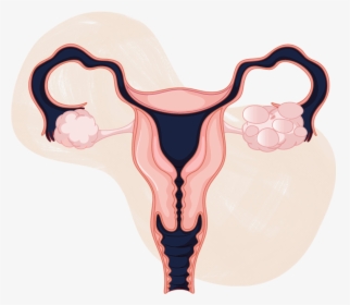 Pcos And Pregnancy - Ovarian Cancer Drawing, HD Png Download, Free Download