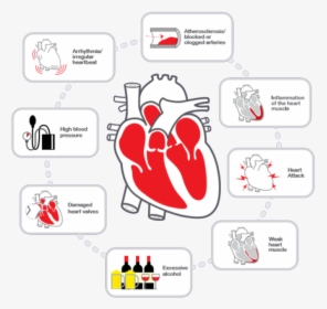 Heart Failure - Parallel, HD Png Download, Free Download