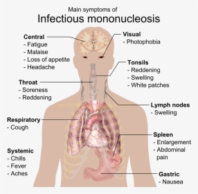 Main Symptoms Of Infectious Mononucleosis, HD Png Download, Free Download