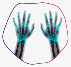 Fingers - X-ray, HD Png Download, Free Download