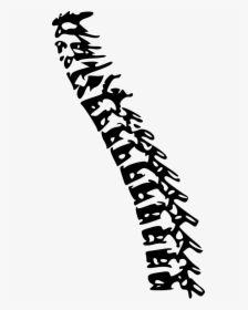Surgery Drawing Spine - Spine Surgery Clipart, HD Png Download, Free Download