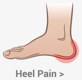 Heel-pain - Ball Of Foot Pain, HD Png Download - kindpng