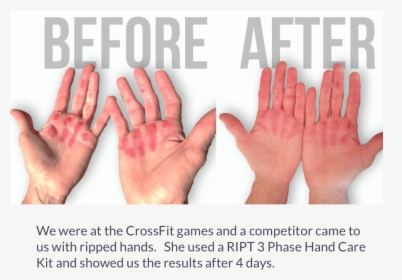 By The Time The Skin Rips Off, It Will Be A Lot Dryer - Sign Language, HD Png Download, Free Download