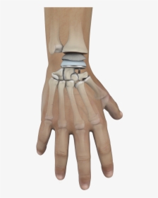 Wrist Joint Replacement, HD Png Download, Free Download