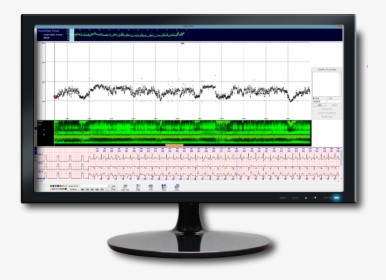Heart Rate Trending - Computer Monitor, HD Png Download, Free Download